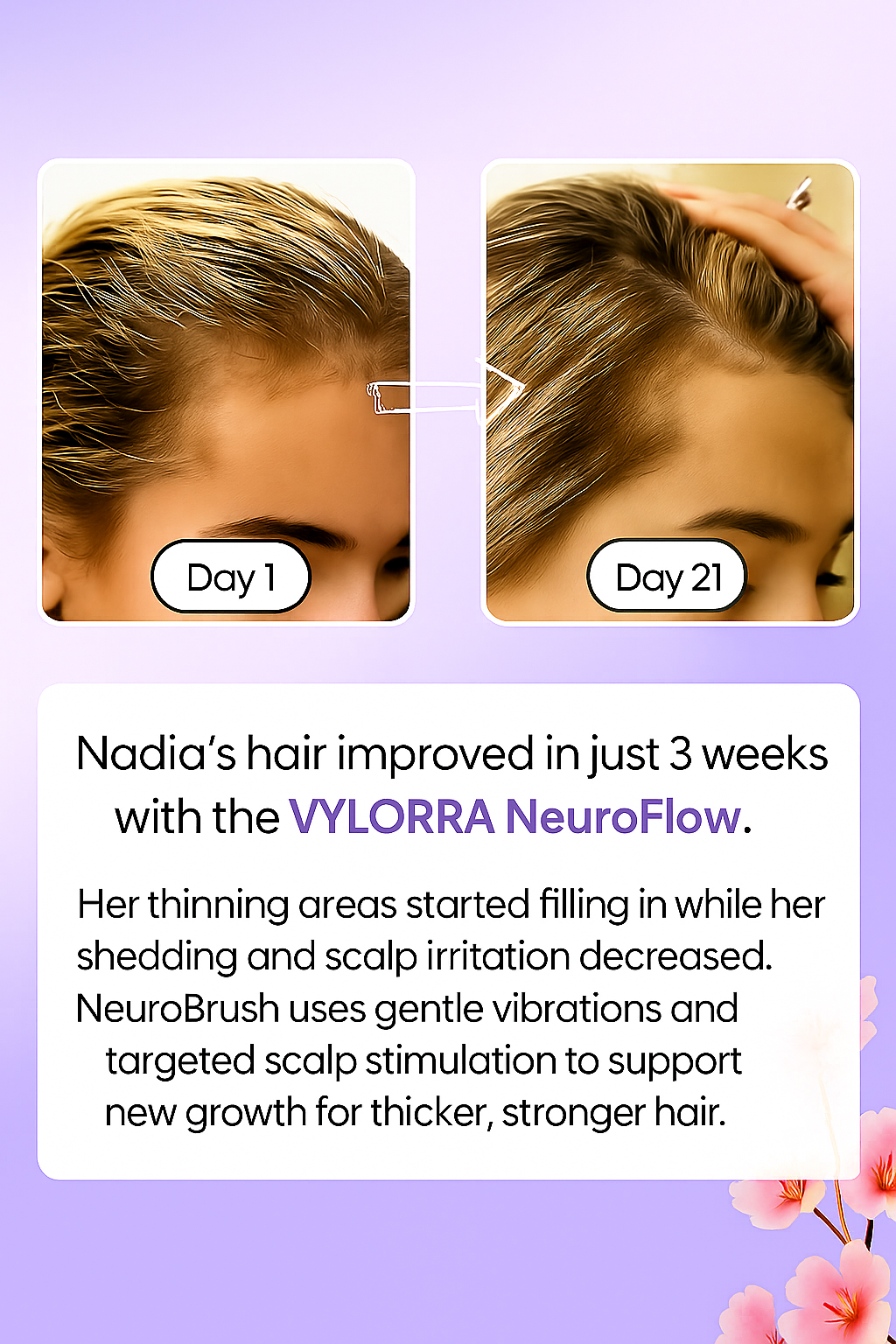 NeuroFlow™ Scalp Massager